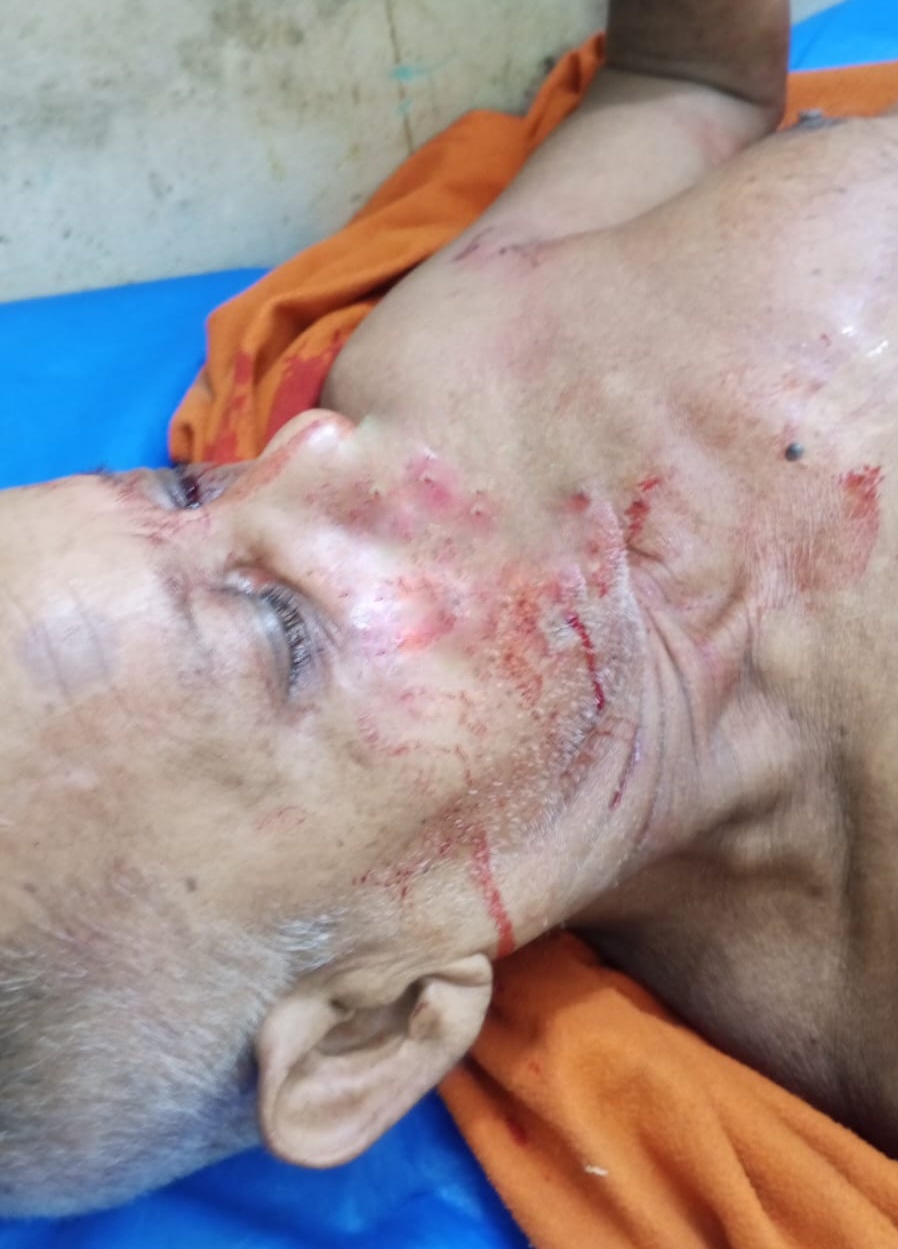 বাবাকে কোদাল দিয়ে কুপিয়ে রক্তাক্ত, হামলা ঠেকাতে গিয়ে বড় ভাইয়ের স্ত্রীও আহত