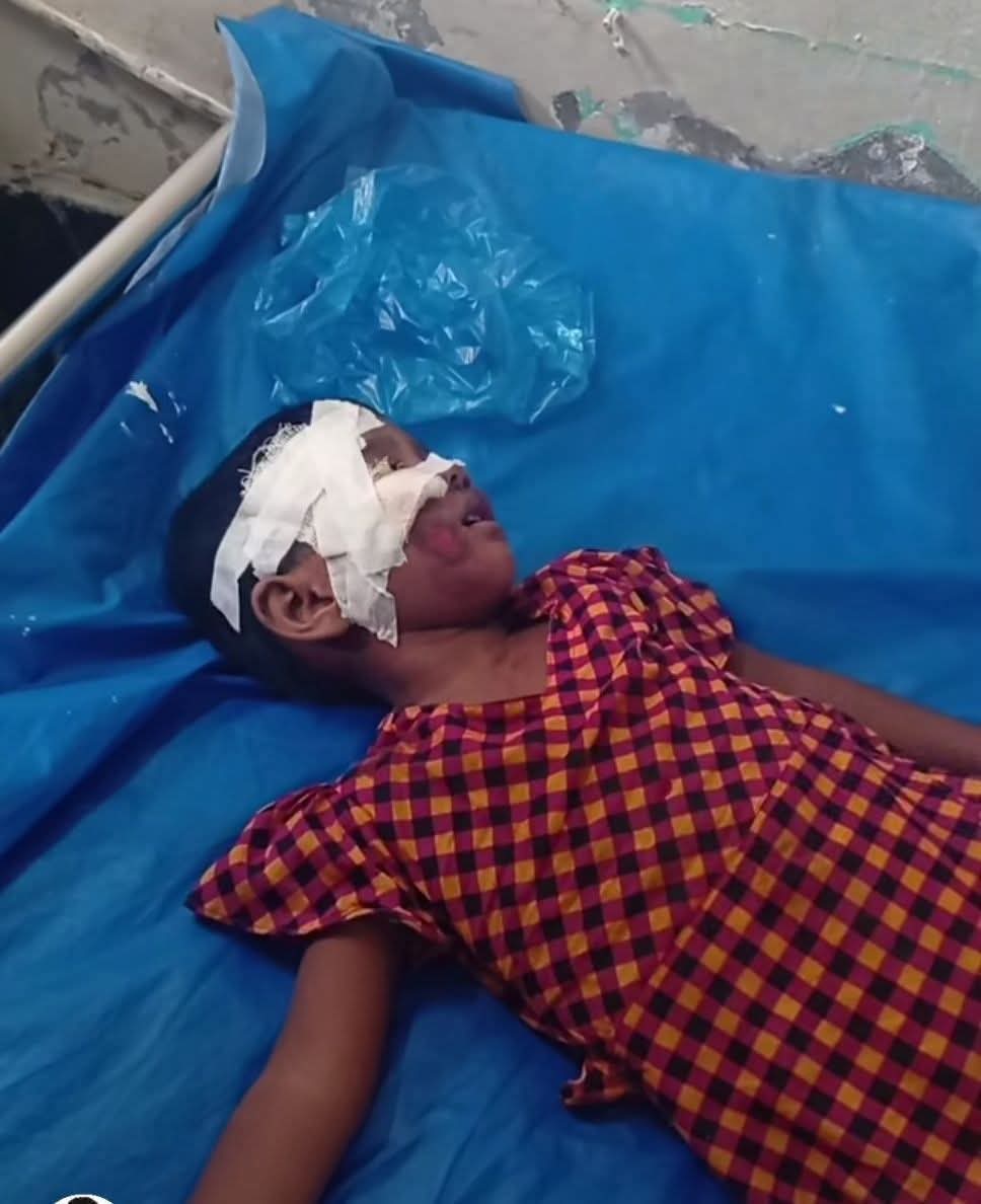বামনায় বেপরোয়া অটোর চাপায় প্রাণ গেল ৮ বছরের শ্রেষ্ঠার।